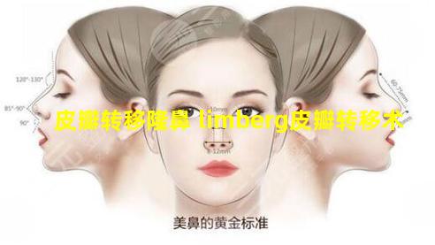 皮瓣转移隆鼻 limberg皮瓣转移术